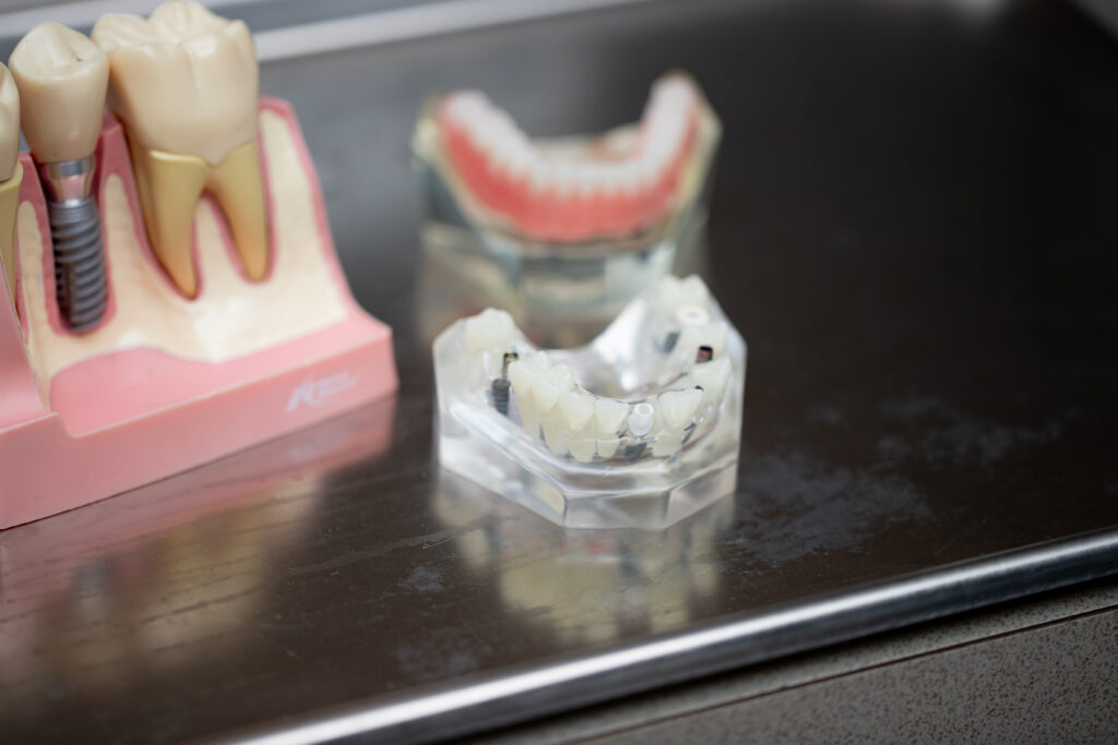 An example of what a dental implant looks like