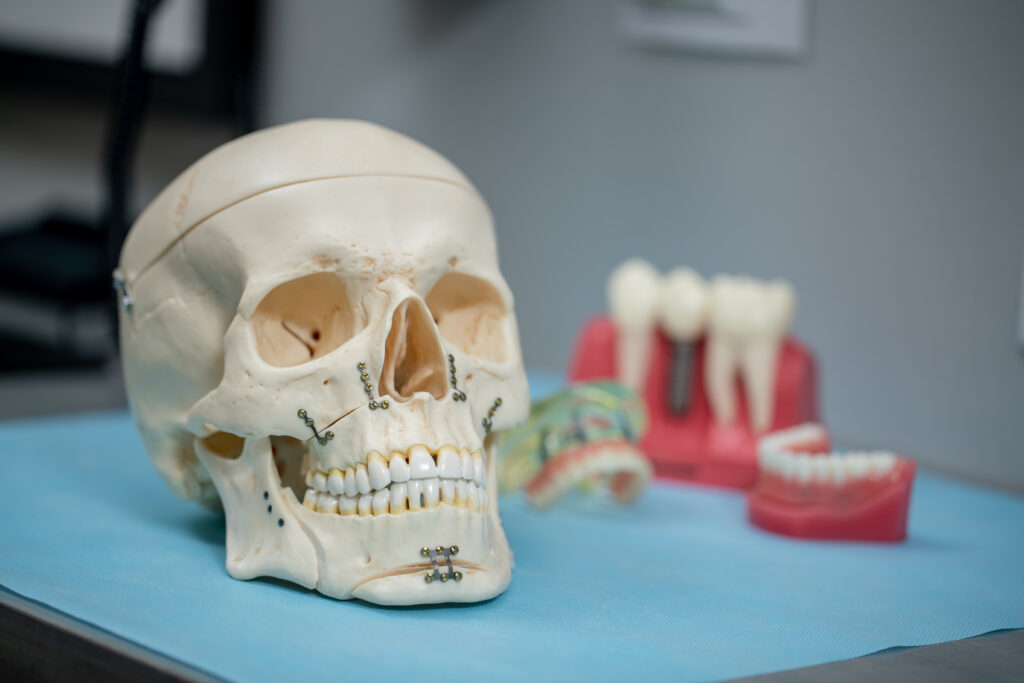 A skull that shows correct jaw alignment for jaw surgery